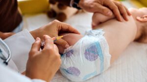 Trẻ sinh mổ có thể giảm nguy cơ mắc viêm gan B nhờ ít tiếp xúc dịch cơ thể của mẹ khi chào đời. Tìm hiểu kết quả nghiên cứu mới.