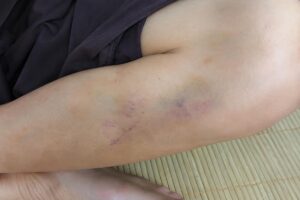 Vụ bạo hành trẻ tại chùa Bầu khiến nhiều cháu có thương tích. Cơ quan chức năng đang xác minh, giám định và làm rõ trách nhiệm.