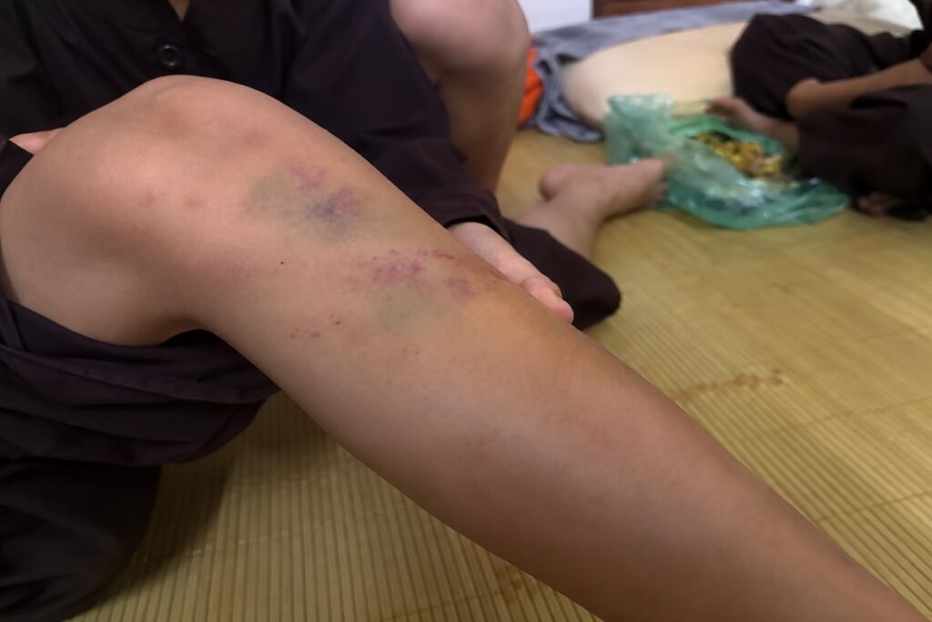 Vụ bạo hành trẻ tại chùa Bầu: nhiều cháu được xác định có thương tích, cơ quan chức năng đang làm rõ vụ việc và trách nhiệm liên quan.