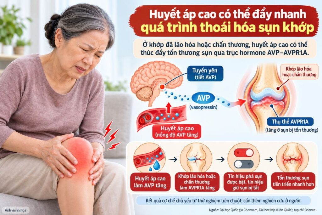 Nghiên cứu mới phát hiện huyết áp cao có thể thúc đẩy thoái hóa sụn khớp thông qua cơ chế hormone AVP, mở ra hướng điều trị tiềm năng.